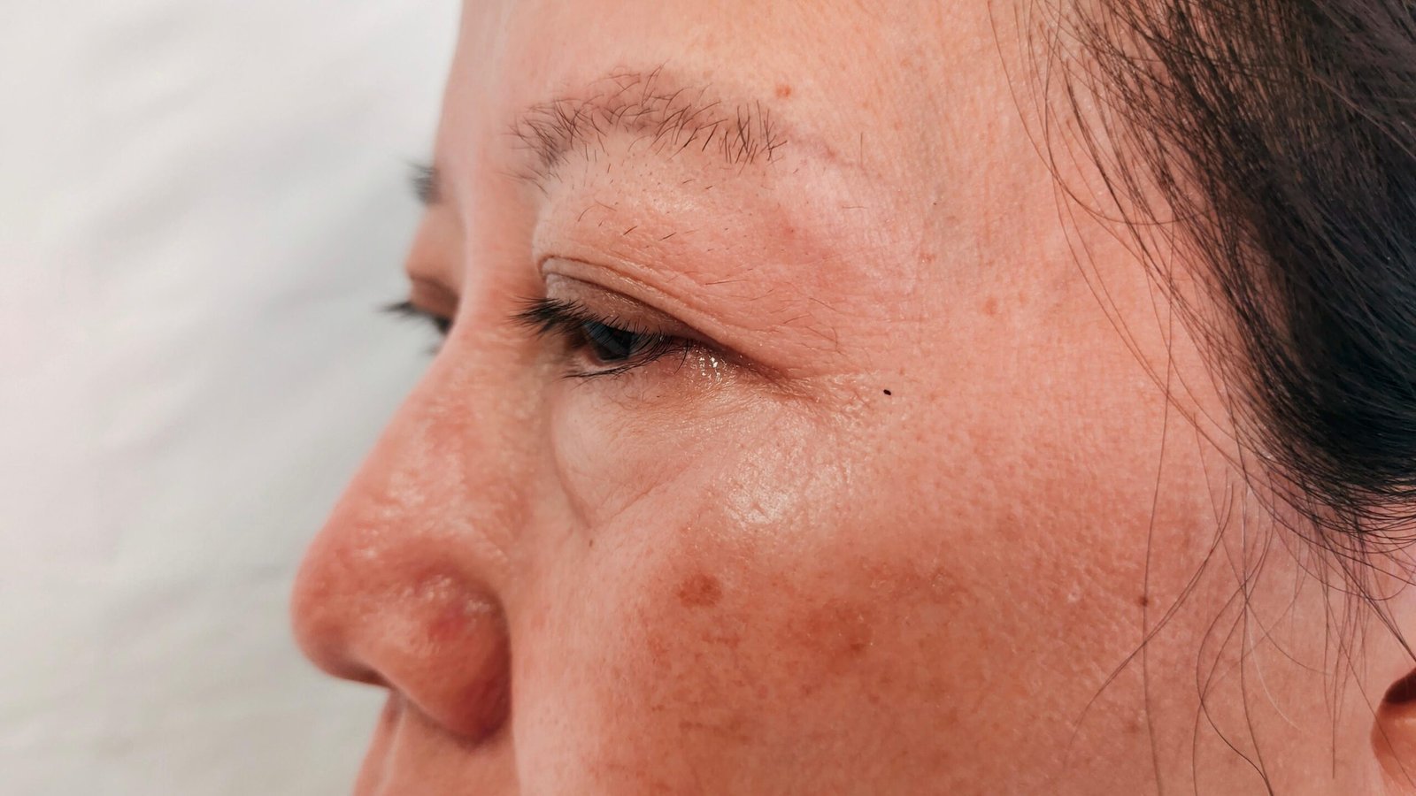 Velvet Laser Clinic|Home